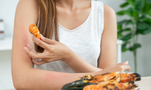 写真_食物アレルギー